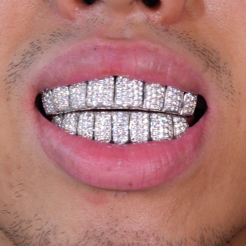 Custom Deep Cut Honeycomb Setting Grillz